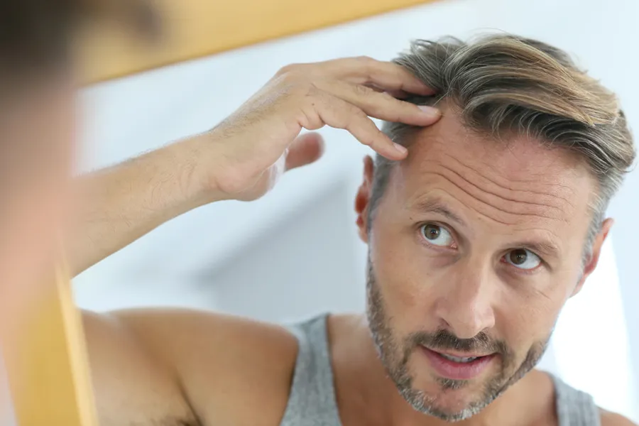 DeriveHairRestoration-Clinic A man losing his hair, looking into the mirror. Receive Derive Hair Restoration Treatment by Regenerative Medical Institute in Greenville.