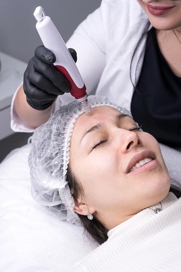 Morpheus8-Treatment(2) Close up of a smiling woman receiving a Morpheus8 Skin Rejuvenation Treatment from Regenerative Medical Institute in Greenville.