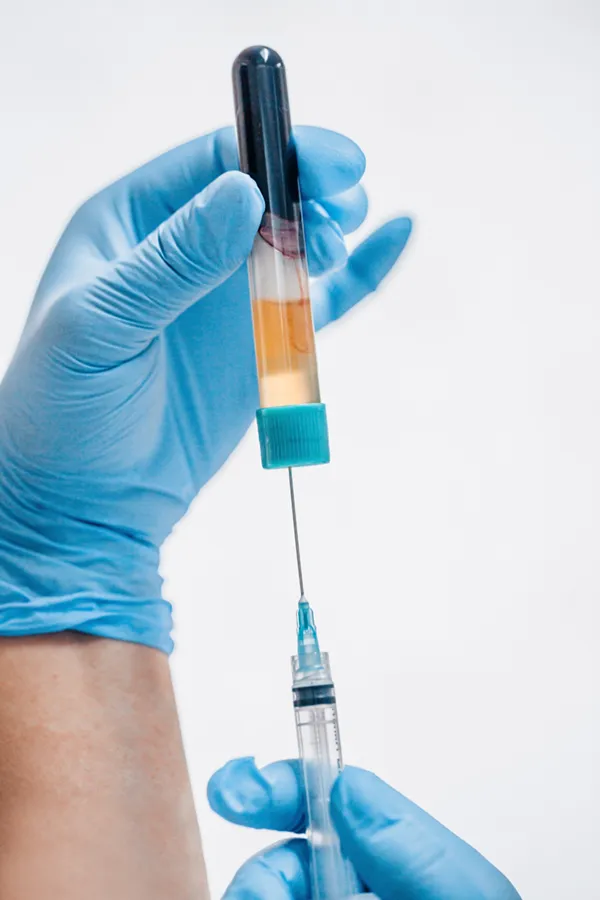 PRP-Vampire-Facelift-Treatment A close-up of a medical practitioner's gloved hands drawing plasma from a vial into a syringe, representing PRP Vampire Facelift treatment from Regenerative Medical Institute in Greenville.