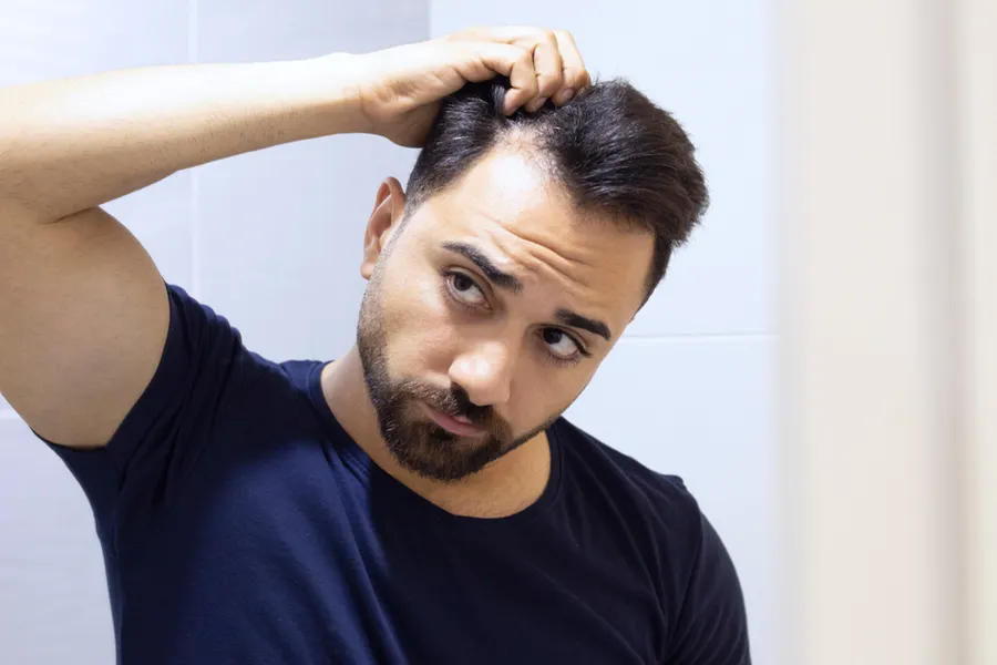 PRP-for-Hair-Loss-Doctor A man in a navy t-shirt looks in the mirror worrying about and touching his receding hairline, considering PRP for hair loss and restoration treatment from Regenerative Medical Institute in Greenville.